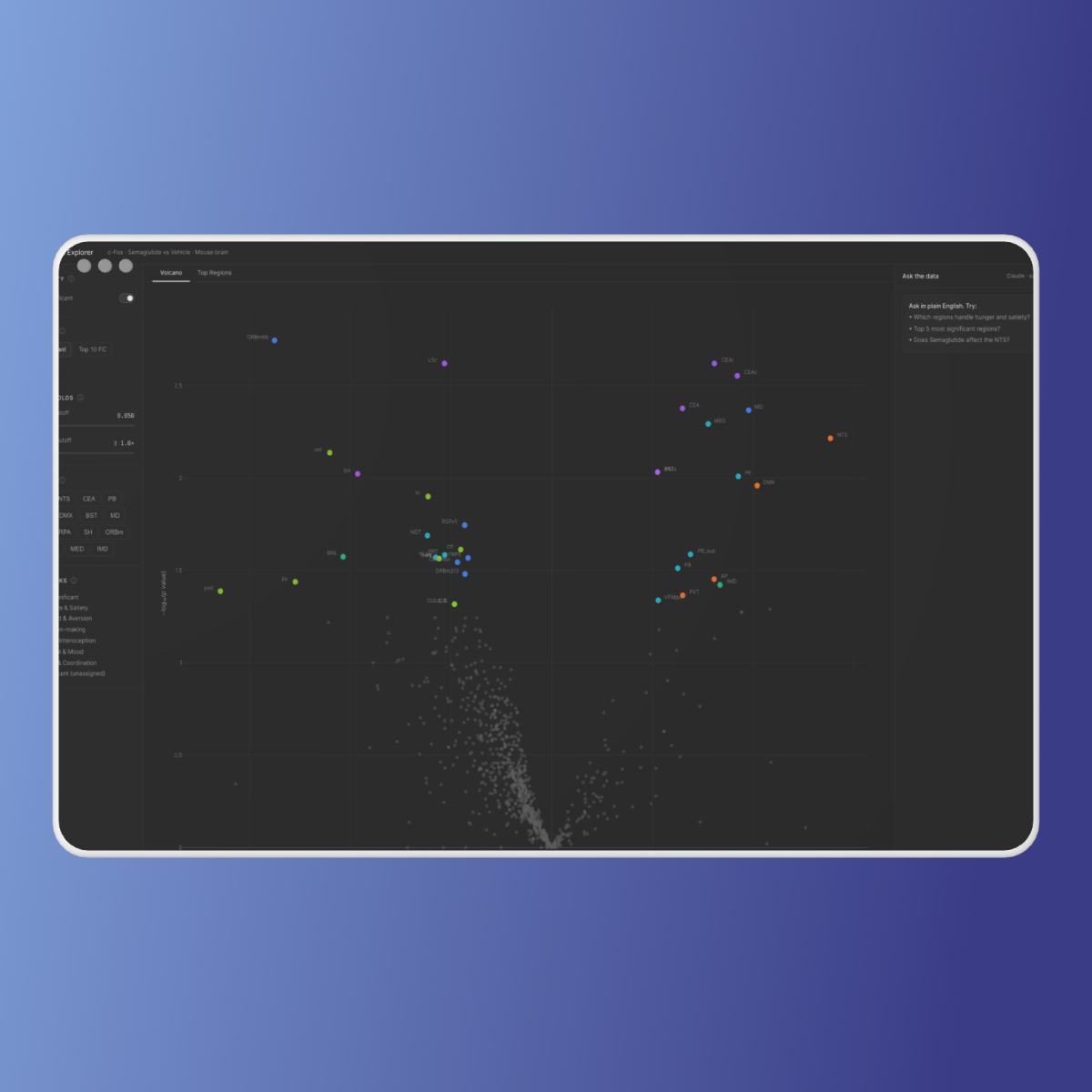 Brain Data Explorer dashboard
